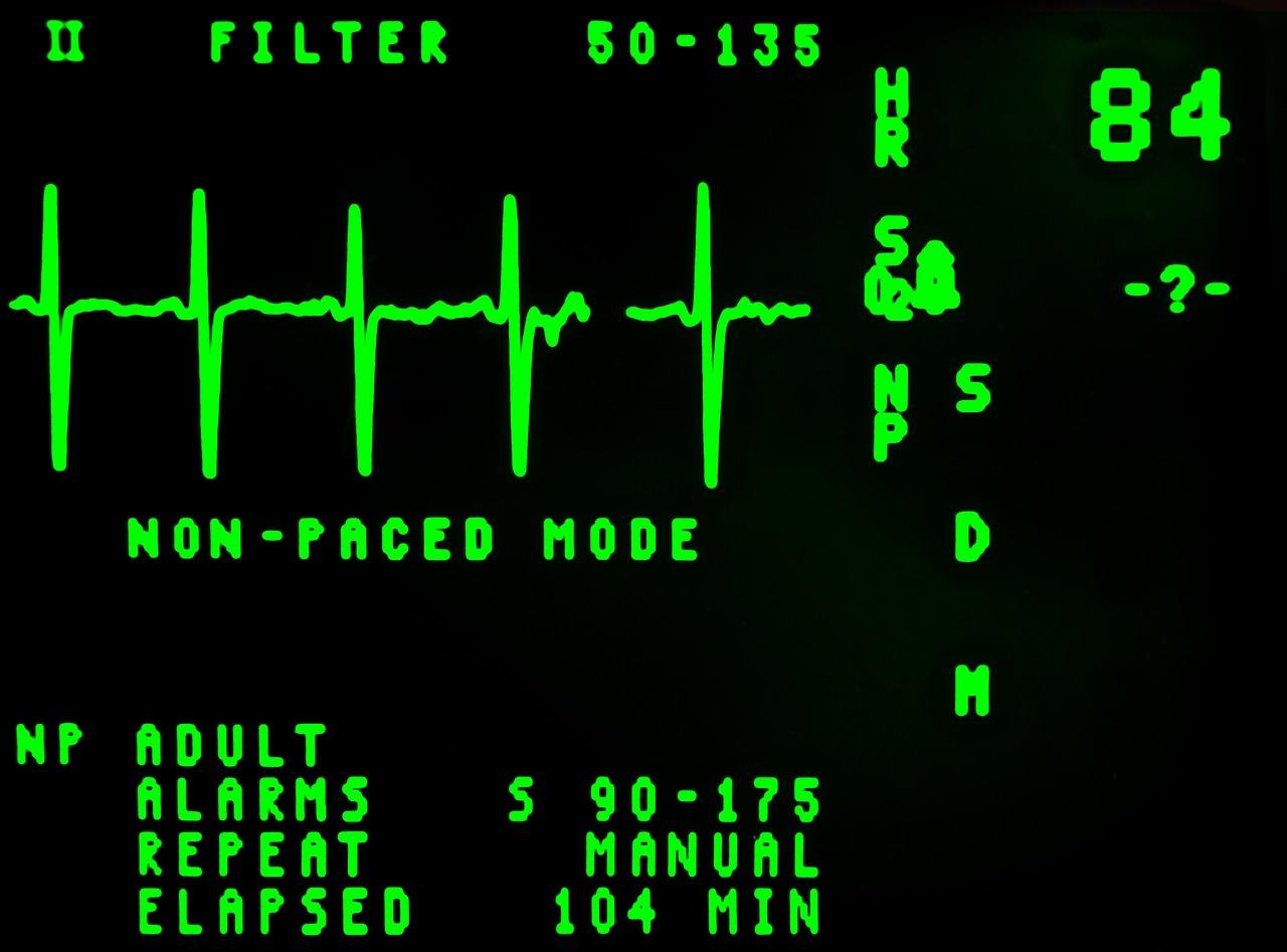 EKG